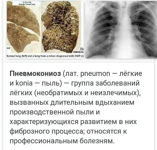 http://images.vfl.ru/ii/1604336982/5fa9e3ba/32162396_m.jpg