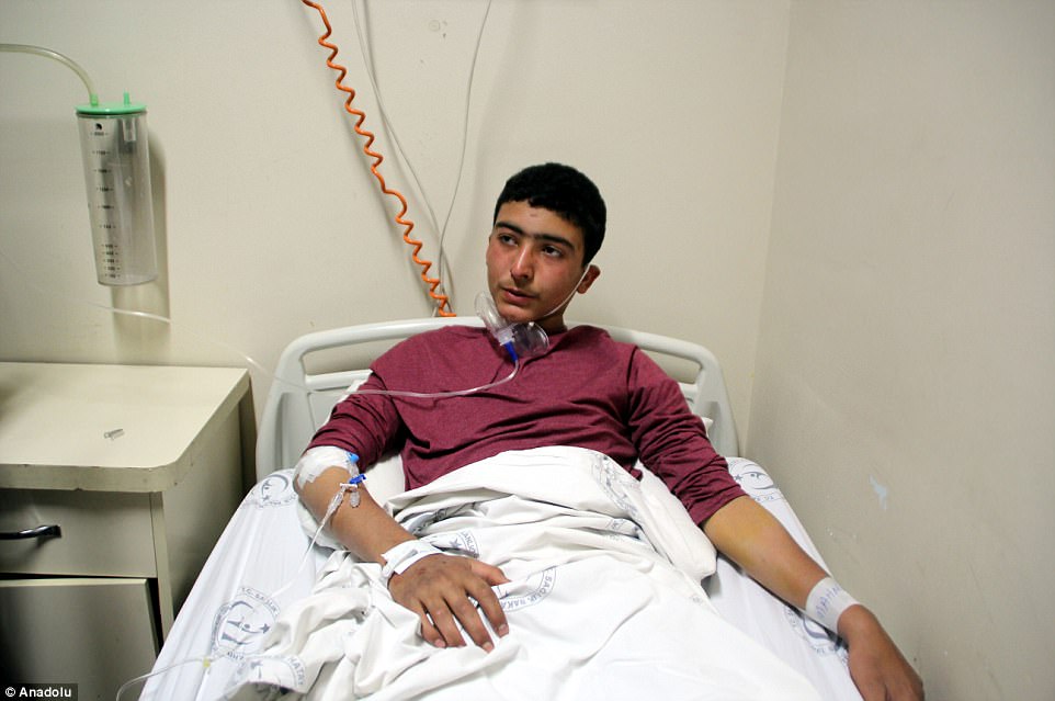 http://i.dailymail.co.uk/i/pix/2017/04/05/09/3EF5576E00000578-4381838-Syrian_Mahmut_Mansur_14_receives_treatment_at_Reyhanli_State_Hos-a-22_1491382347082.jpg