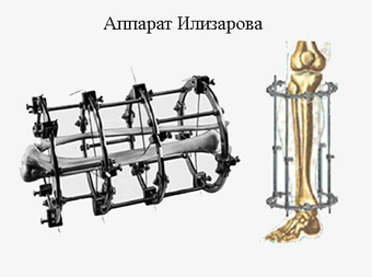 http://images.vfl.ru/ii/1506057645/5b54ebe1/18690086.jpg