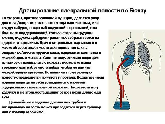 http://images.vfl.ru/ii/1542876695/d0cb35f7/24306573_m.jpg