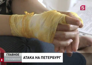 http://images.vfl.ru/ii/1501240666/91b38b7a/18061648_m.jpg