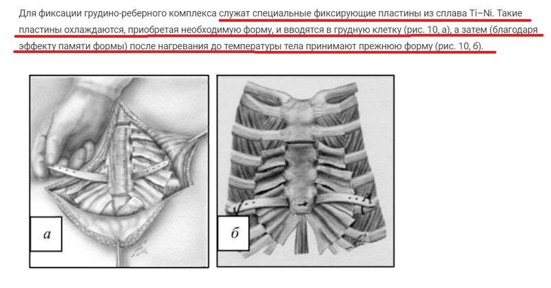 http://images.vfl.ru/ii/1617006312/e13e6a56/33863152.jpg