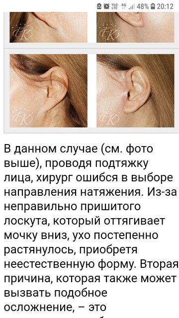 https://i.ibb.co/tpFfcp8/Screenshot-20201108-201245-Chrome.jpg