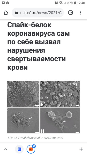 https://i.ibb.co/Rv7Zy1S/Screenshot-20210714-124034-Chrome.jpg