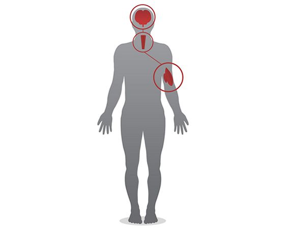 http://static.euronews.com/articles/277582/560x450_1408-Ebola-2.jpg