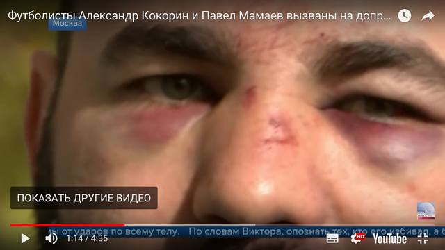 http://images.vfl.ru/ii/1539158493/28df6939/23728913_m.jpg
