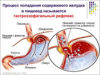 http://images.vfl.ru/ii/1563211252/5aa5fa03/27217300_s.jpg