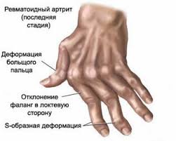 http://se.uploads.ru/t/gk7m2.jpg